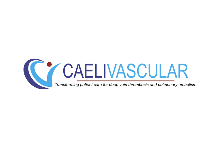 CaeliVascular